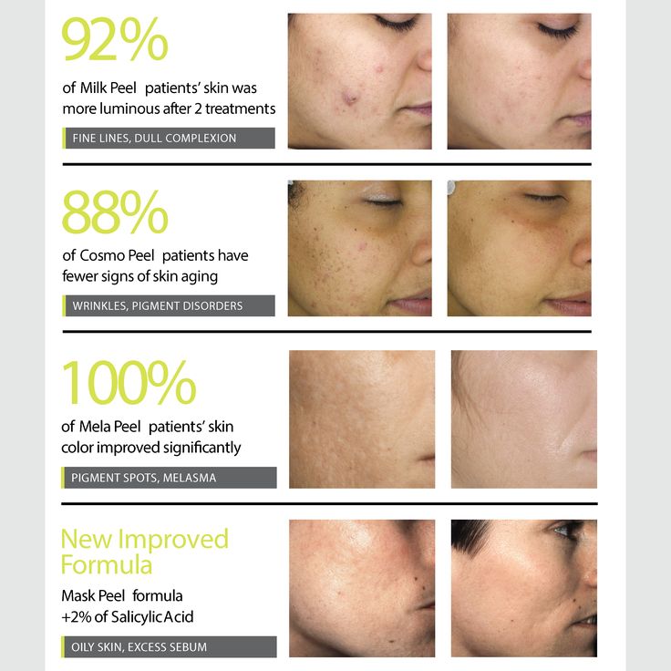 Advanced Brightening Tranexamine