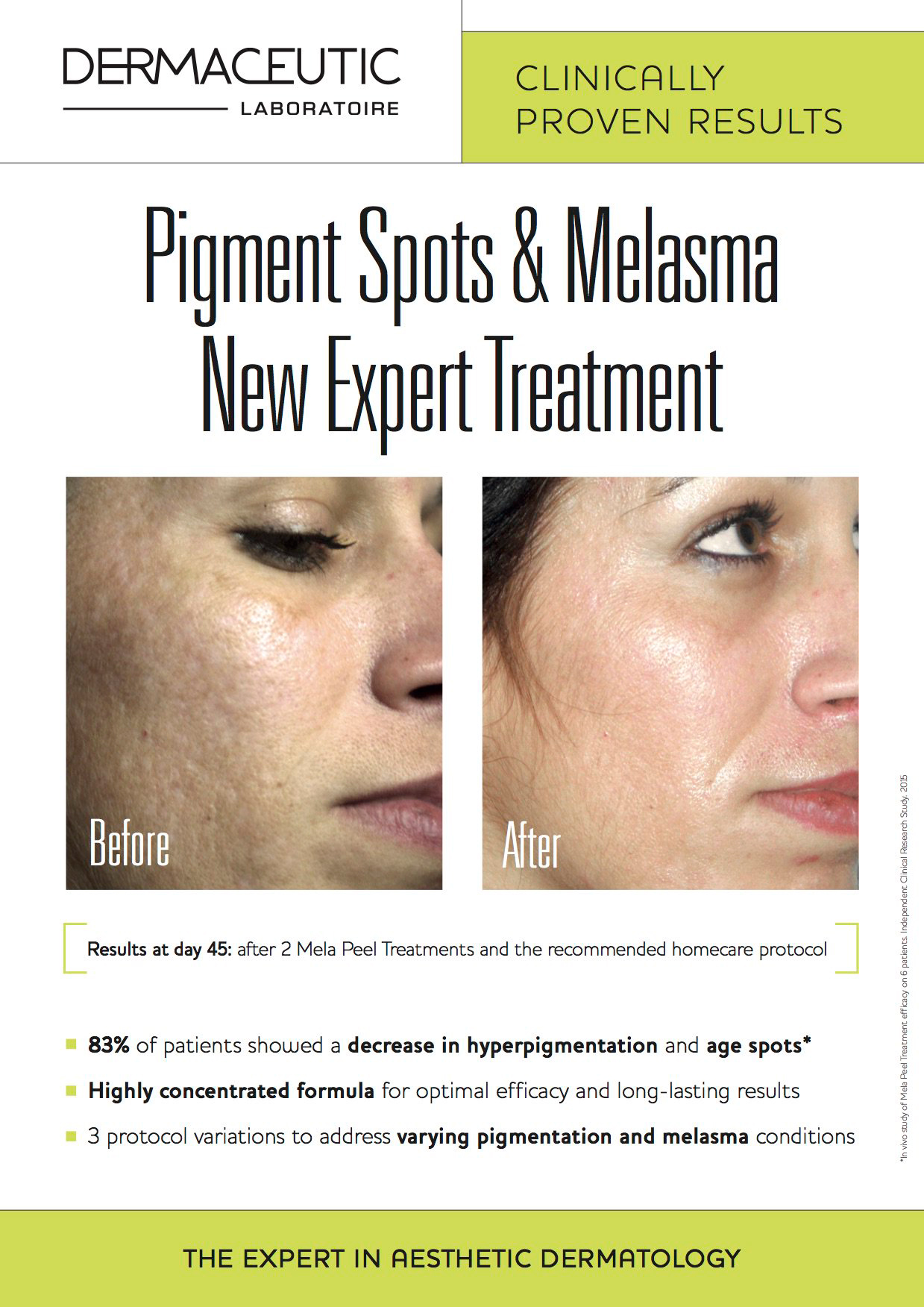 Advanced Brightening Tranexamine